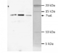 PsaL | PSI-L subunit of photosystem I (cyanobacterial)